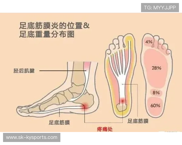 跑步后脚踝疼?2026 专业理疗师教你辨别是扭伤还是筋膜炎。,跑步后感觉脚踝脚筋肿 跑步后脚踝疼?2026 专业理疗师教你辨别是扭伤还是筋膜炎。,跑步后感觉脚踝脚筋肿